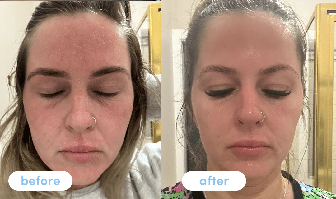 where to buy peptides, where can I buy peptides, buy peptides online, peptides supplier, peptides for sale, trusted peptide supplier, pharmaceutical grade peptides, lab tested peptides, high purity peptides, peptides online secure checkout, peptides fast delivery, peptides next day delivery, licensed peptide supplier, regulated peptide provider, buy peptides safely, prescription peptides UK, clinical grade peptides, medical grade peptides, authentic peptides supplier, verified peptide supplier, peptides UK supplier, UK peptide supplier, peptides for research UK, research peptides supplier, buy peptides online UK, peptides UK fast delivery, peptides UK next day delivery, peptides UK secure checkout, high quality peptides UK, safe peptide purchase, genuine peptide supplier, peptides online pharmacy UK, peptides consultation UK, peptides prescription pathway UK, peptides medical approval UK, peptides healthcare provider UK, peptides licensed distribution UK, peptides regulated pharmacy UK, peptides UK shipping, peptides UK tracked delivery, peptides weight management UK, peptides treatment support UK, peptides research grade UK, pharmaceutical peptides UK, approved peptide supplier UK, secure peptide ordering UK, peptides UK authentic supply, peptides UK verified pharmacy, peptides UK patient access, peptides UK order online, peptides UK trusted provider, peptides UK legal purchase, peptides UK clinical review, peptides UK medical supervision, peptides UK secure delivery, peptides UK high purity supply, peptides UK laboratory tested, peptides UK licensed prescriber, peptides UK safe supply, peptides UK official supplier, peptides UK compliant provider, peptides UK regulated distribution, peptides UK secure purchase, peptides UK healthcare supply, peptides UK fast shipping, where to buy retatrutide UK, buy retatrutide online UK, retatrutide UK supplier, retatrutide for sale UK, retatrutide research grade UK, retatrutide UK fast delivery, retatrutide UK prescription, retatrutide UK online pharmacy, buy prescription retatrutide UK, retatrutide UK licensed supplier, retatrutide UK approved pharmacy, retatrutide UK consultation, retatrutide UK clinical review, retatrutide UK legal purchase, retatrutide UK authentic, retatrutide UK verified supplier, retatrutide UK safe ordering, retatrutide UK tracked delivery, retatrutide weight management UK, retatrutide treatment UK, retatrutide UK medical supply, retatrutide UK shipping, retatrutide UK secure checkout, retatrutide UK dosage, retatrutide online UK regulated, retatrutide UK lab tested, buy retatrutide UK safely, retatrutide UK prescription pathway, UK retatrutide supplier, retatrutide UK healthcare, retatrutide UK approved medication, retatrutide UK prescription only, retatrutide UK patient access, retatrutide UK order online, retatrutide UK genuine supplier, retatrutide UK fast shipping, retatrutide UK next day courier, retatrutide UK medical approval, retatrutide UK clinical grade, retatrutide UK high quality, retatrutide UK research support, retatrutide UK licensed prescriber, retatrutide UK online consultation, retatrutide UK official supplier, retatrutide UK authentic medication, retatrutide UK purchase safely, retatrutide UK for weight loss, retatrutide UK trusted supplier, retatrutide UK verified pharmacy, retatrutide UK approved product, retatrutide UK medical supervision, retatrutide UK secure ordering, retatrutide UK regulated pharmacy, retatrutide UK UK delivery, retatrutide UK top rated supplier, retatrutide UK online order UK, retatrutide UK safe supply, retatrutide UK licensed distribution,